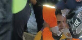 Coro| Colisión entre motos dejó un panadero lesionado