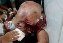 Municipio Sucre| Conductor chocó con un poste