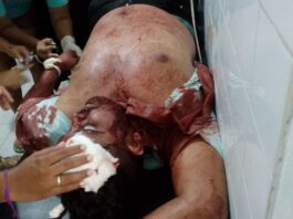 Municipio Sucre| Conductor chocó con un poste