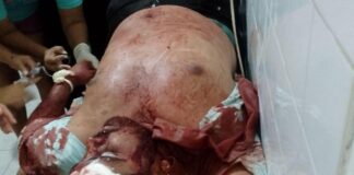 Municipio Sucre| Conductor chocó con un poste