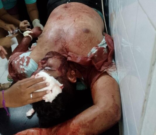 Municipio Sucre| Conductor chocó con un poste