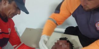 Municipio Falcón| Dos lesionados por deslizamiento de moto en Adícora