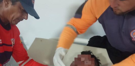 Municipio Falcón| Dos lesionados por deslizamiento de moto en Adícora