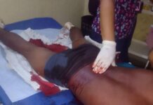 Municipio Falcón| Herido por arma blanca en Pueblo Nuevo