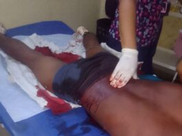 Municipio Falcón| Herido por arma blanca en Pueblo Nuevo