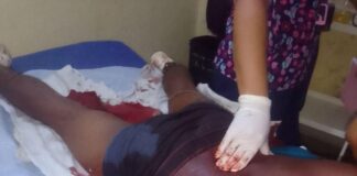 Municipio Falcón| Herido por arma blanca en Pueblo Nuevo