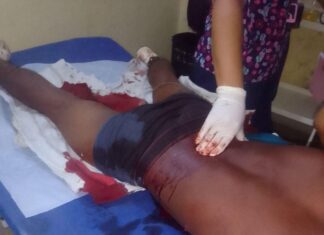 Municipio Falcón| Herido por arma blanca en Pueblo Nuevo