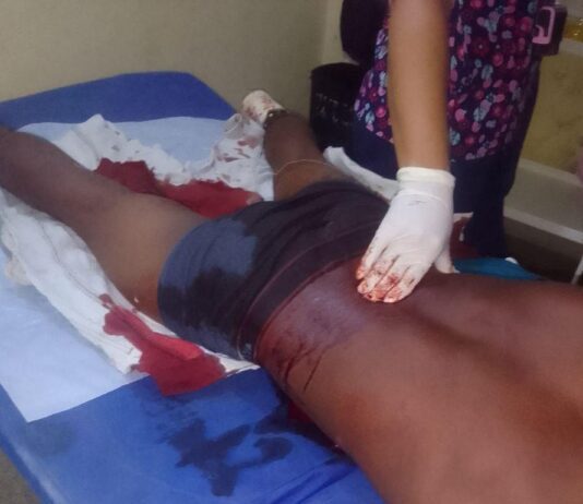 Municipio Falcón| Herido por arma blanca en Pueblo Nuevo