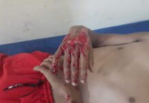 Municipio Falcón| Motorizado rodó en El Vínculo