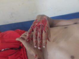 Municipio Falcón| Motorizado rodó en El Vínculo