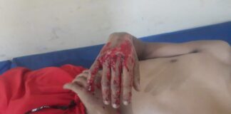 Municipio Falcón| Motorizado rodó en El Vínculo