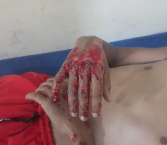 Municipio Falcón| Motorizado rodó en El Vínculo