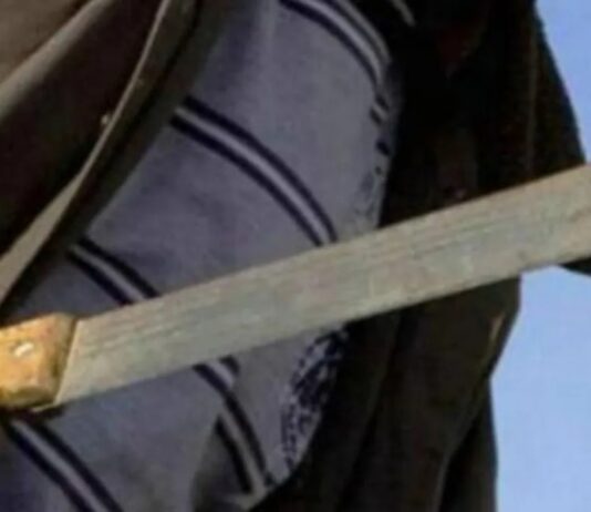 Municipio Buchivacoa| Atacadas a machetazos una mujer y su hija de diez años