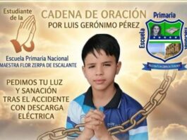 Municipio Zamora| Niño sufre quemaduras tras caerle una guaya encima