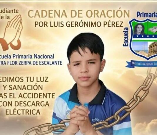 Municipio Zamora| Niño sufre quemaduras tras caerle una guaya encima