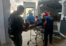 Municipio Falcón| Trabajador sufrió serias lesiones en el rostro en accidente laboral