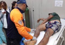 Mauroa| Joven sufrió doble fractura tras caerse de un burro