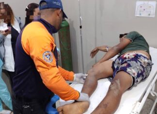 Mauroa| Joven sufrió doble fractura tras caerse de un burro