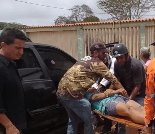 Municipio Falcón| Un niño y un joven lesionados en deslizamiento de moto en Buenevara
