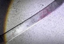 Punto Fijo| Tío le cortó la cara a su sobrino con un machete