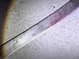 Punto Fijo| Tío le cortó la cara a su sobrino con un machete