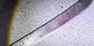 Punto Fijo| Tío le cortó la cara a su sobrino con un machete