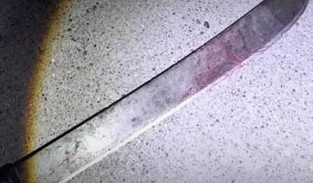 Punto Fijo| Tío le cortó la cara a su sobrino con un machete