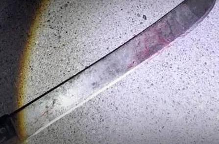 Punto Fijo| Tío le cortó la cara a su sobrino con un machete