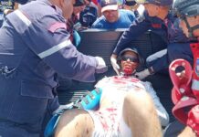 Carirubana| Motorizado evitó colisionar con un automóvil y se fue al pavimento