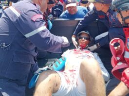 Carirubana| Motorizado evitó colisionar con un automóvil y se fue al pavimento