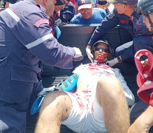 Carirubana| Motorizado evitó colisionar con un automóvil y se fue al pavimento