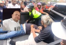 Coro| Falleció motorizado que fue arrollado en la avenida Alí Primera