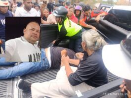 Coro| Falleció motorizado que fue arrollado en la avenida Alí Primera