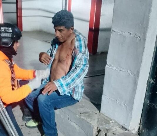 Punto Fijo| Se resistió al robo y lo hirieron con un cuchillo