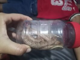 Municipio Falcón| Niño es mordido por una serpiente