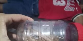 Municipio Falcón| Niño es mordido por una serpiente
