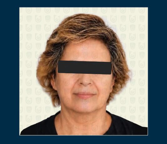 La Guaira| De esta manera aprehendieron a la mexicana que asesinó a la nuera