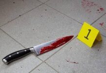 Municipio Carirubana| Herido con arma blanca