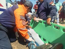 Coro| Mototaxista sufrió serias lesiones en una colisión