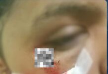 Zulia| Detenido sujeto por maltratar a su sobrina