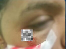 Zulia| Detenido sujeto por maltratar a su sobrina