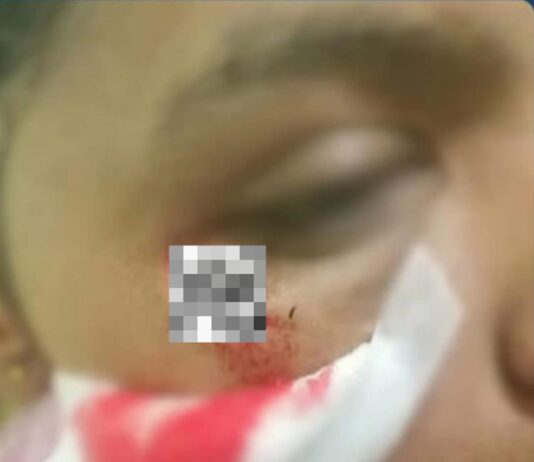 Zulia| Detenido sujeto por maltratar a su sobrina