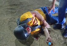 Motorizado resultó lesionado tras aparatoso derrape en la intercomunal Alí Primera
