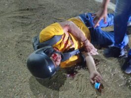 Motorizado resultó lesionado tras aparatoso derrape en la intercomunal Alí Primera
