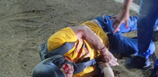 Motorizado resultó lesionado tras aparatoso derrape en la intercomunal Alí Primera