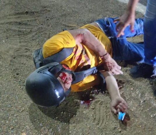 Motorizado resultó lesionado tras aparatoso derrape en la intercomunal Alí Primera