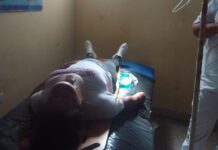 ¡Susto en la vía! Una mujer resultó herida tras impactar contra una cabra