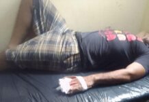 Sufrió graves heridas en las manos tras accidente laboral con un esmeril en San José