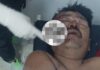 Pescador resultó herido tras accidente vial en la Carretera Falcón-Zulia