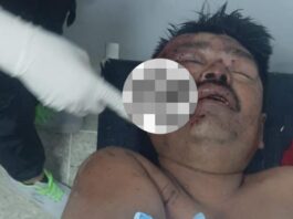 Pescador resultó herido tras accidente vial en la Carretera Falcón-Zulia